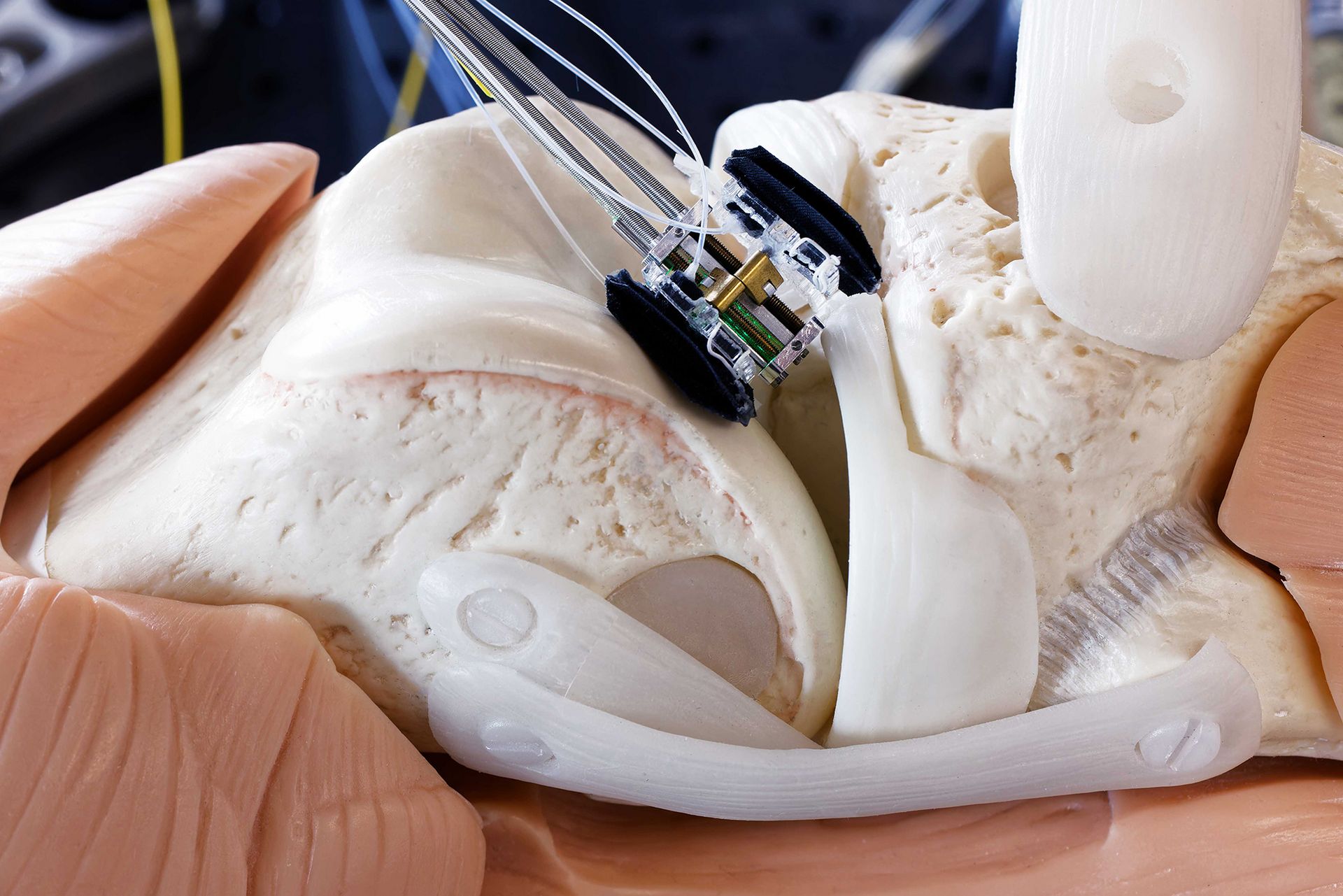 The surgical robot affixes itself in the gap of the knee joint