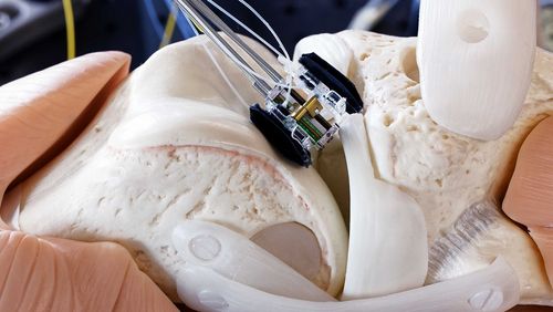 The surgical robot affixes itself in the gap of the knee joint