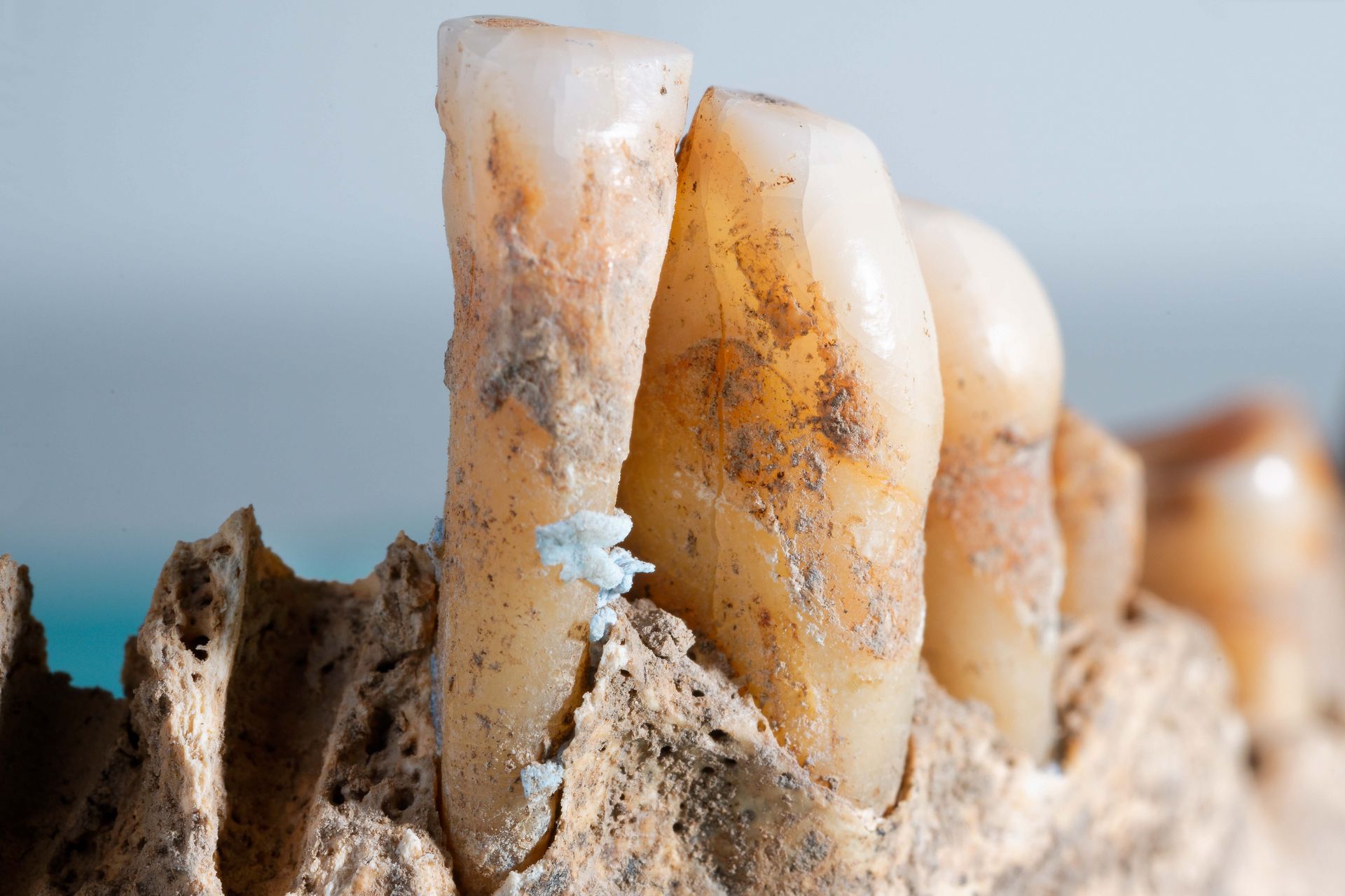 Prehistoric dental plaque