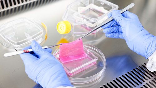 Die am Universitäts-Kinderspital Zürich entwickelte PV-Skin ist der weltweit erste Hautersatz, der vier verschiedene Zelltypen der menschlichen Haut enthält.