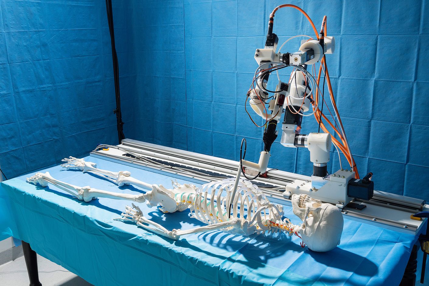 Operating on a humerus using robot-guided laser technology.